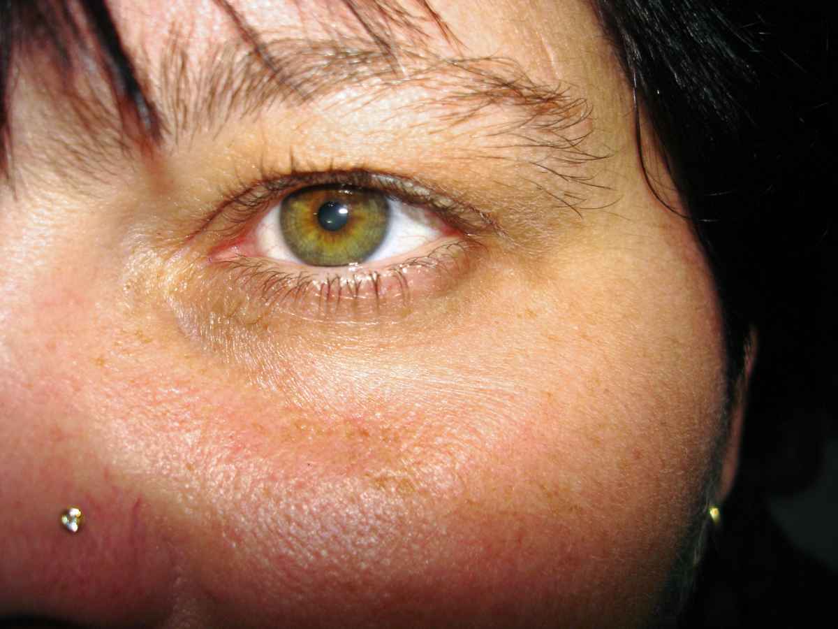 Jessie's Auge