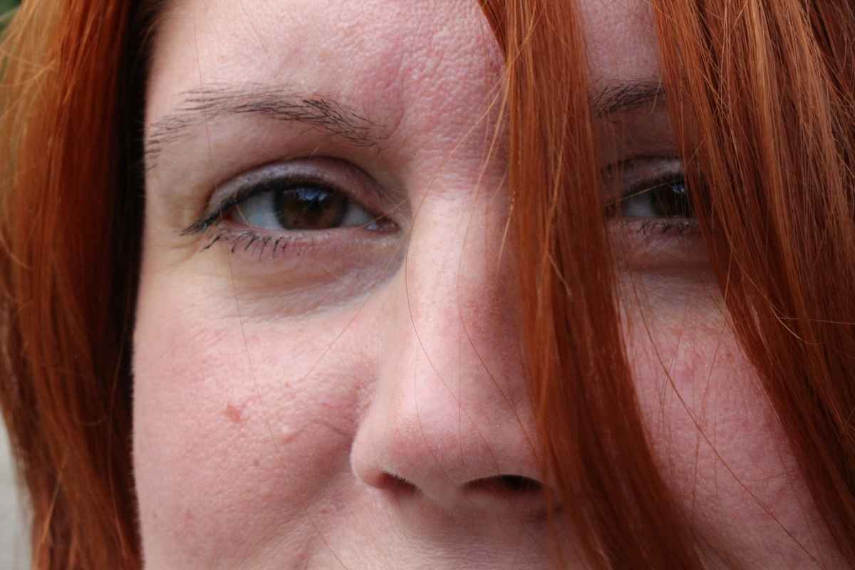 Blick