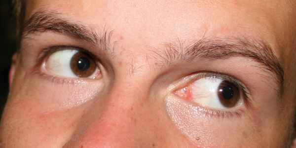 Wohin schauen Deine Augen?
