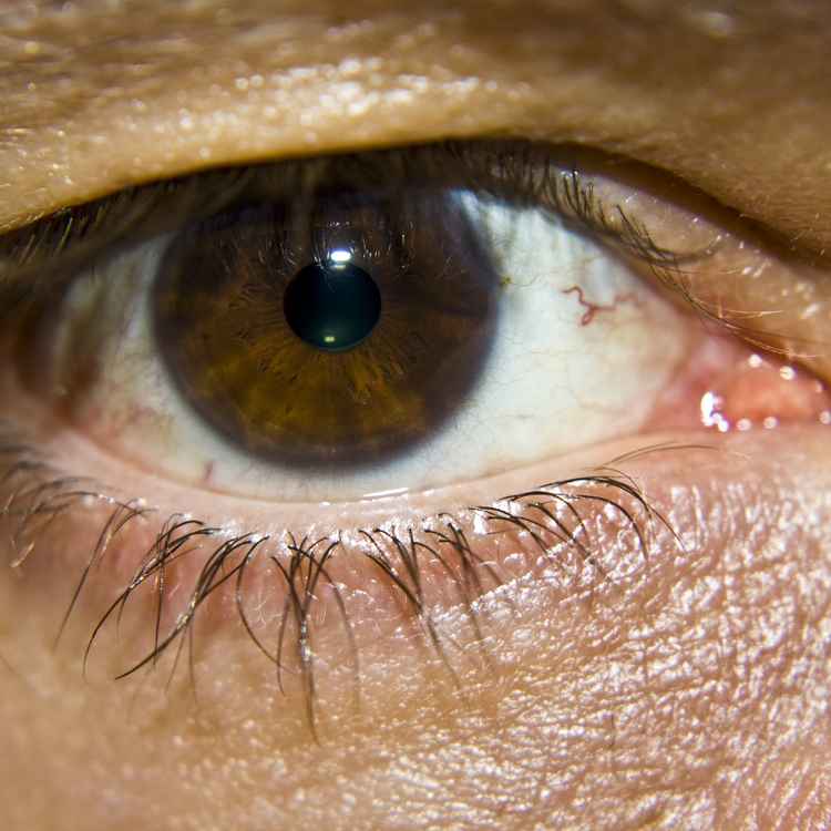 Auge