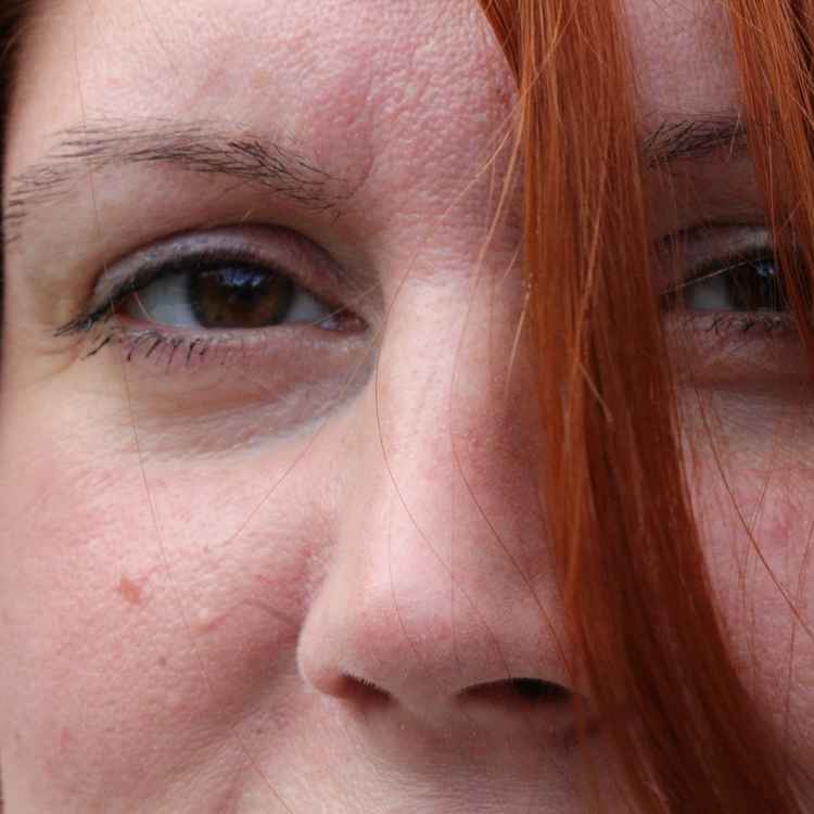 Blick