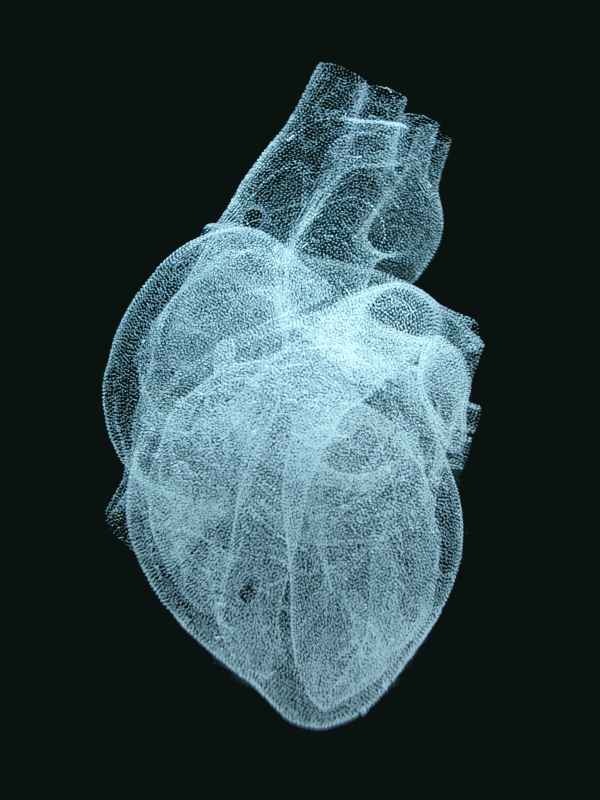 Herz (anatomisch) in Glas gelasert