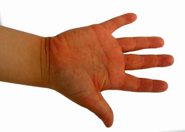 Kinderhand Handteller rechts