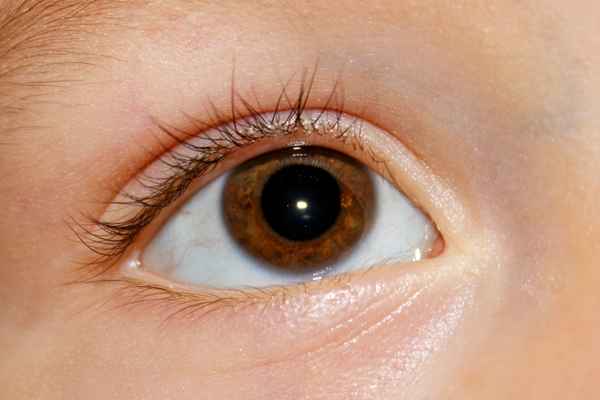 Auge