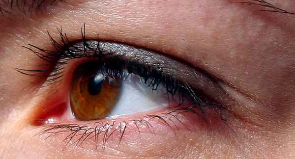 Auge