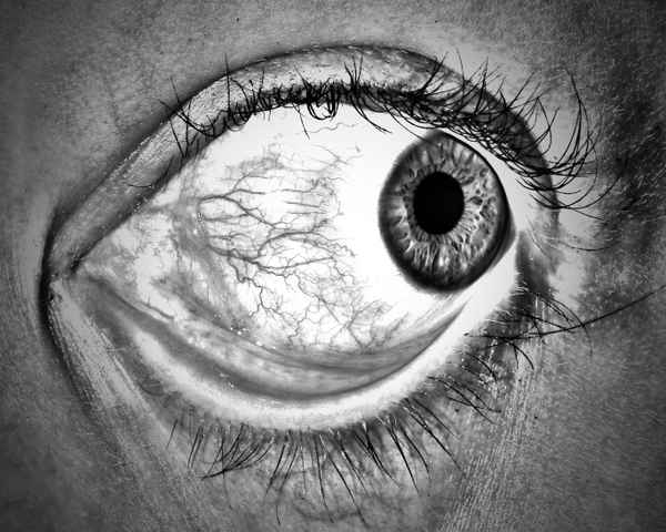 Auge