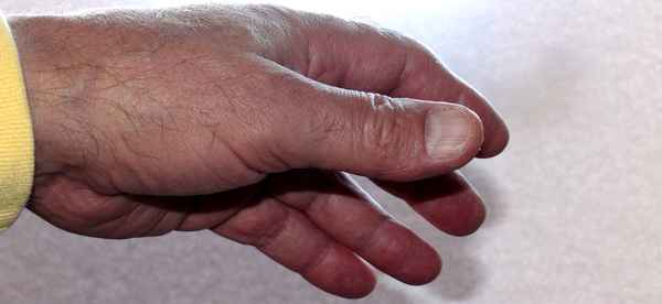 Offene Hand III