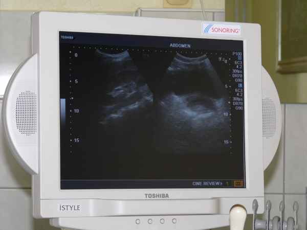 Ultraschall 2