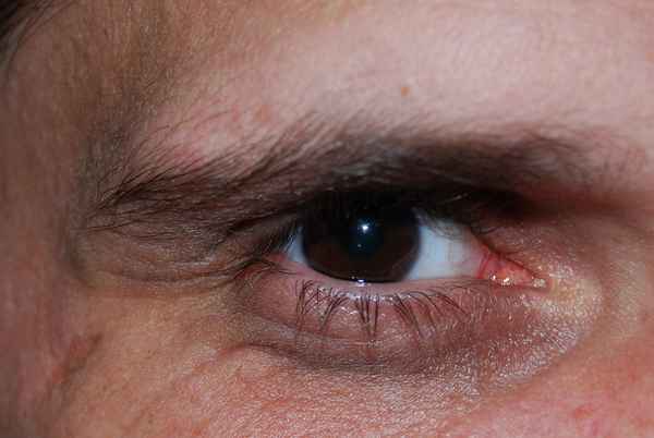 das Auge