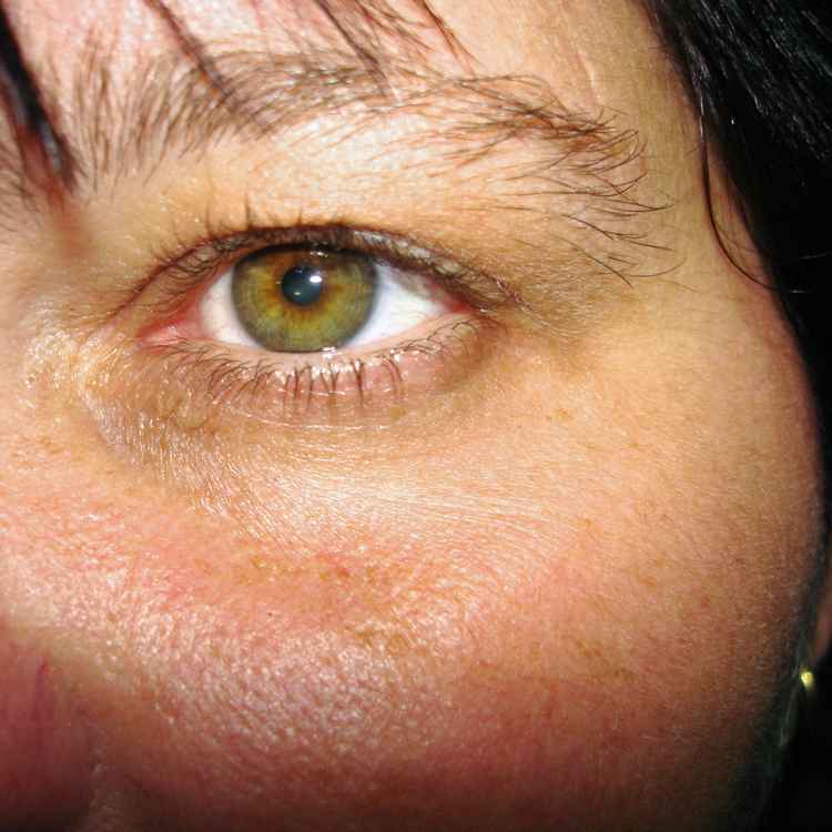 Jessie's Auge