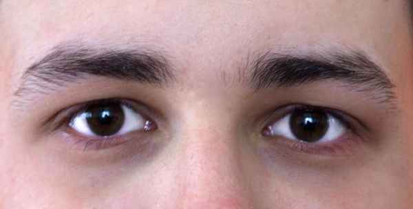 Augen