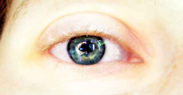 Auge