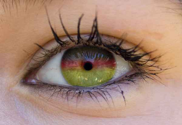 German Eye