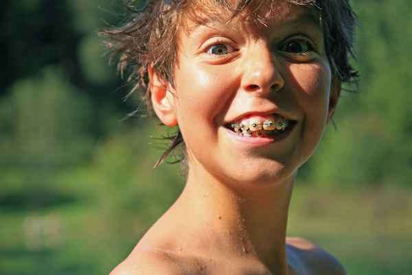Junge mit Zahnspange