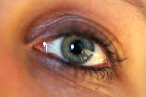 eye