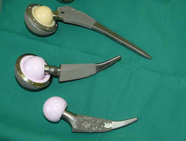 Künstliches Hüftgelenk