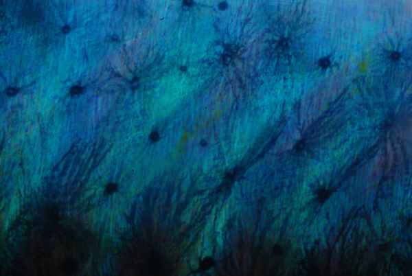 Netzwerk auf der Haut