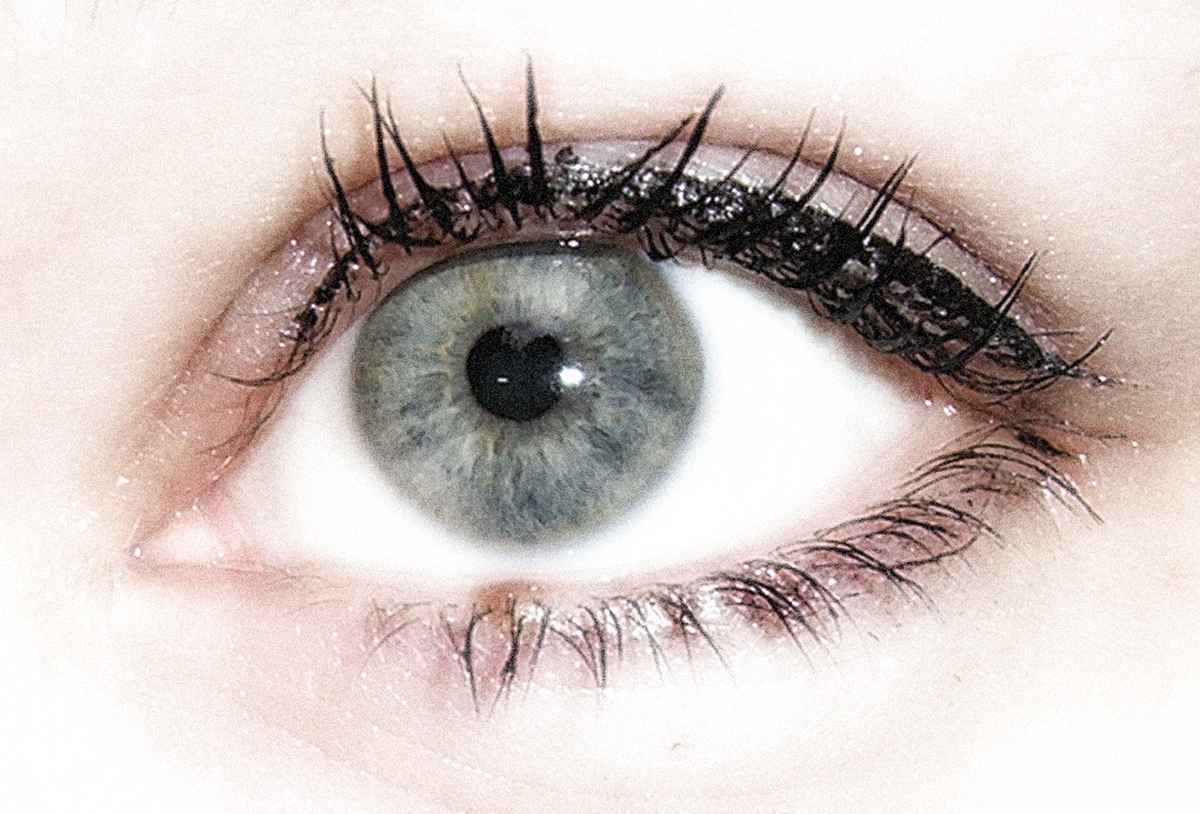 auge1