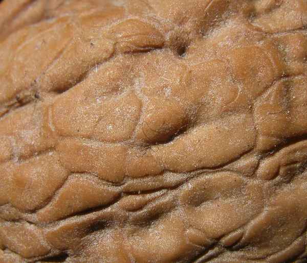 Und was ist das bitteschön? Gelöst... Detail einer Walnuß!