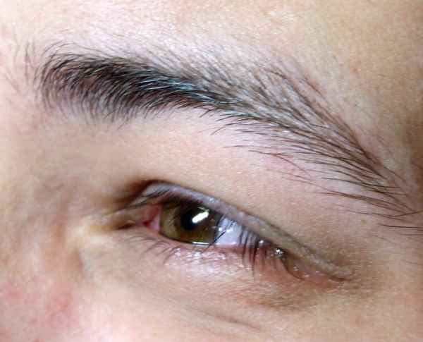 Auge