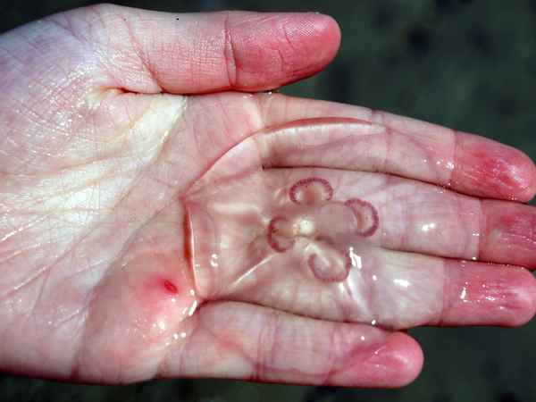 Kinderhand mit Qualle