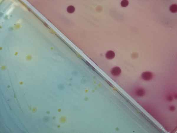 Petrischale mit Bakterienkultur