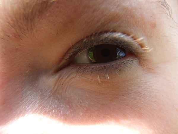 Auge