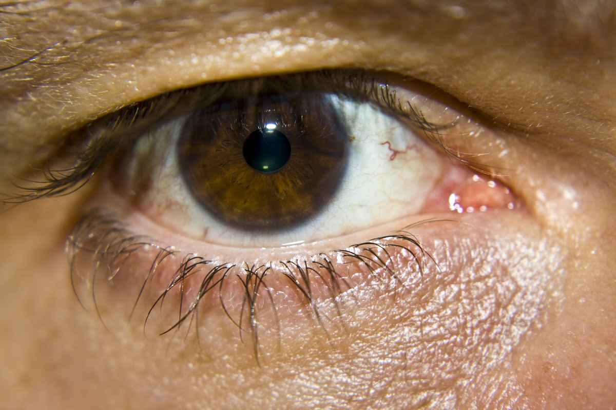 Auge